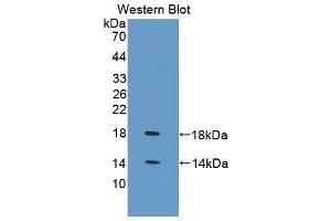Western blot analysis of the recombinant protein. (FABP4 Antikörper  (AA 1-125))