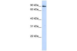 PCSK5 antibody used at 1 ug/ml to detect target protein. (PCSK5 Antikörper  (Middle Region))
