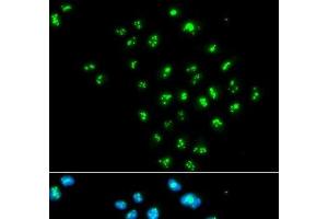 Immunofluorescence analysis of MCF-7 cells using EIF6 Polyclonal Antibody (EIF6 Antikörper)