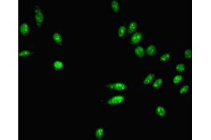 Immunofluorescent analysis of Hela cells using ABIN7163761 at dilution of 1:100 and Alexa Fluor 488-congugated AffiniPure Goat Anti-Rabbit IgG(H+L) (PARN Antikörper  (AA 1-639))