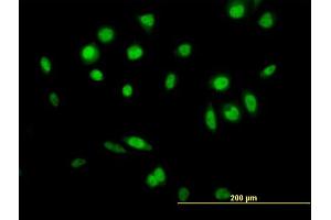 Immunofluorescence of  purified  MaxPab antibody to GPS1 on HeLa cell. (GPS1 Antikörper  (AA 1-527))