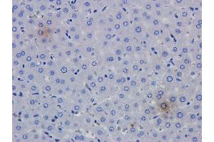 Immunohistochemical analysis of rat liver using anti-TNFalpha antibody   Formalin fixed rat liver slices were stained with a  at 5 µg/ml.