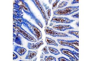 IHC analysis of CD31/Pecam1 using anti-CD31/Pecam1 antibody (ABIN7601662). (CD31 Antikörper  (AA 41-258))