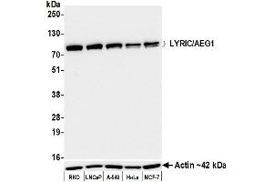 Western Blotting (WB) image for anti-Metadherin (MTDH) (AA 475-525) antibody (ABIN7795651) (Rekombinanter MTDH Antikörper  (AA 475-525))
