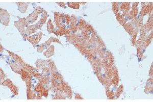 Immunohistochemistry (Paraffin-embedded Sections) (IHC (p)) image for anti-Acyl-CoA Synthetase Long-Chain Family Member 3 (Acsl3) antibody (ABIN7255720)