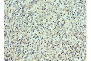 Immunohistochemistry of paraffin-embedded human spleen tissue using ABIN7145171 at dilution of 1:100 (BCL11A Antikörper  (AA 1-230))