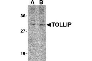 Western Blotting (WB) image for anti-Toll Interacting Protein (TOLLIP) (C-Term) antibody (ABIN1030762) (TOLLIP Antikörper  (C-Term))