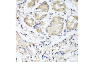 Immunohistochemistry of paraffin-embedded human stomach using NID1 antibody at dilution of 1:100 (40x lens).