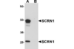 Western Blotting (WB) image for anti-Secernin 1 (SCRN1) (C-Term) antibody (ABIN1030648) (Secernin 1 Antikörper  (C-Term))