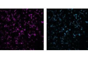 Immunofluorescence analysis of human tonsil frozen section using CD8 (C8/144B, 5 μg/mL) Mouse mAb, labelled with Alexa Fluor® 568 (left, control) and CD8 (3ALB177, 10 μg/mL) monoclonal LIMAAbody®, labelled with Alexa Fluor® 647, on Zeiss Observer 7. (Rekombinanter CD8 Antikörper  (Extracellular Domain))