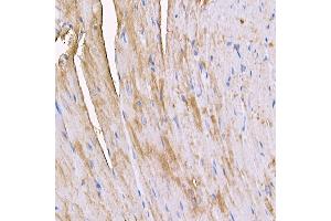 Immunohistochemistry (IHC) image for anti-Myosin Heavy Chain 4, Skeletal Muscle (MYH4) (AA 1450-1550) antibody (ABIN7268749)
