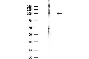 anti-SRY (Sex Determining Region Y)-Box 30 (SOX30) antibody