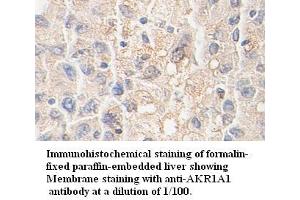 Image no. 1 for anti-Aldo-Keto Reductase Family 1, Member A1 (Aldehyde Reductase) (AKR1A1) antibody (ABIN791183) (AKR1A1 Antikörper)