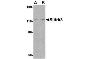 Image no. 1 for anti-SLIT and NTRK-Like Family, Member 3 (SLITRK3) (C-Term) antibody (ABIN1493367) (SLITRK3 Antikörper  (C-Term))