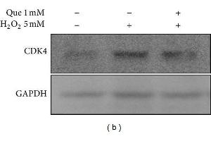 Western Blotting (WB) image for anti-Glyceraldehyde-3-Phosphate Dehydrogenase (GAPDH) antibody (ABIN2857072)