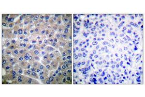 Immunohistochemistry (IHC) image for anti-Breast Cancer Anti-Estrogen Resistance 1 (BCAR1) (Tyr410) antibody (ABIN1847916) (BCAR1 Antikörper  (Tyr410))