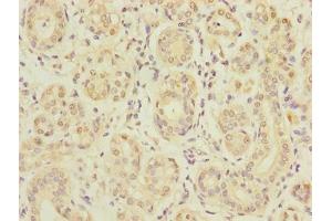 Immunohistochemistry of paraffin-embedded human salivary gland tissue using ABIN7170019 at dilution of 1:100 (SLC5A1 Antikörper  (AA 239-288))