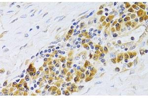 Immunohistochemistry of paraffin-embedded Human esophagus using PA2G4 Polyclonal Antibody at dilution of 1:100 (40x lens). (PA2G4 Antikörper)