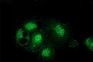 Anti-GSS mouse monoclonal antibody (ABIN2453904) immunofluorescent staining of COS7 cells transiently transfected by pCMV6-ENTRY GSS (RC203174). (Glutathione Synthetase Antikörper)