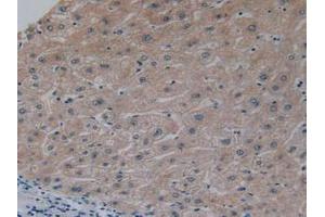 IHC-P analysis of Human Liver Tissue, with DAB staining. (NFkB Antikörper  (AA 805-892))