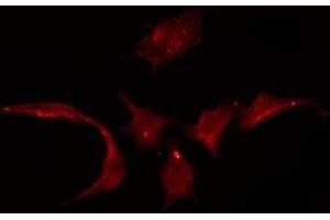 ABIN6275333 staining HuvEc by IF/ICC. (SLC22A3 Antikörper  (Internal Region))