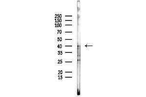 anti-Non Imprinted in Prader-Willi/Angelman Syndrome 2 (NIPA2) antibody