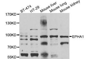 Western blot analysis of extracts of various cell lines, using EPHA1 antibody. (EPHA1 Antikörper)