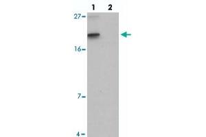 Western blot analysis of SPINK2 in mouse heart tissue with SPINK2 polyclonal antibody  at 1 ug/mL in (lane 1) the absence and (lane 2) the presence of blocking peptide. (SPINK2 Antikörper  (C-Term))