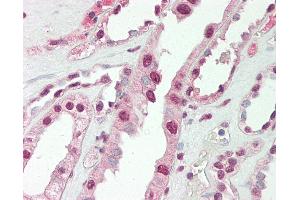 Immunohistochemistry (IHC) image for anti-Cbp/p300-Interacting Transactivator, with Glu/Asp-Rich Carboxy-terminal Domain, 1 (CITED1) (AA 69-118) antibody (ABIN6755409)