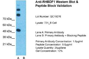 Host:  Rabbit  Target Name:  RHBDF1  Sample Type:  721_B Whole Cell  Lane A:  Primary Antibody  Lane B:  Primary Antibody + Blocking Peptide  Primary Antibody Concentration:  1ug/ml  Peptide Concentration:  5ug/ml  Lysate Quantity:  25ug/lane/Lane  Gel Concentration:  0. (RHBDF1 Antikörper  (N-Term))