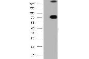 Western Blotting (WB) image for anti-rho GTPase Activating Protein 25 (ARHGAP25) antibody (ABIN1496708) (ARHGAP25 Antikörper)