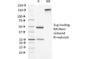 SDS-PAGE Analysis Purified Alpha-1-Antichymotrypsin Monoclonal Antibody (AACT/1451)Confirmation of Integrity and Purity of Antibody. (SERPINA3 Antikörper  (AA 49-187))