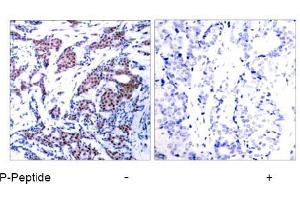 Image no. 1 for anti-Jun Proto-Oncogene (JUN) (pSer73) antibody (ABIN196612) (C-JUN Antikörper  (pSer73))