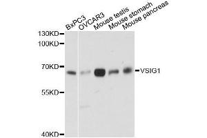 Western blot analysis of extracts of various cell lines, using VSIG1 antibody. (VSIG1 Antikörper  (AA 50-230))