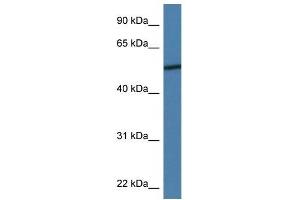 Western Blot showing ADIPOR2 antibody used at a concentration of 1 ug/ml against MDA-MB-435S Cell Lysate