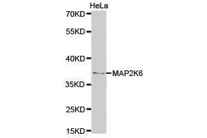 Western Blotting (WB) image for anti-Mitogen-Activated Protein Kinase Kinase 6 (MAP2K6) antibody (ABIN1873609) (MAP2K6 Antikörper)