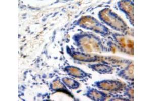 Used in DAB staining on fromalin fixed paraffin-embedded Intestine tissue (BMP2 Antikörper  (AA 24-396))