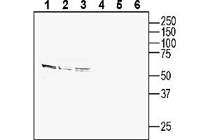Western blot analysis of human  breast adenocarcinoma cell line lysate (lanes 1 and 4), human  MG glioblastoma cell line lysates (lanes 2 and 5) and human LNCaP prostate adenocarcinoma cell line lysate (lanes 3 and 6):1-3.