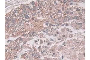Immunohistochemistry (IHC) image for anti-Coxsackie Virus and Adenovirus Receptor (CXADR) (AA 20-229) antibody (ABIN7441556)