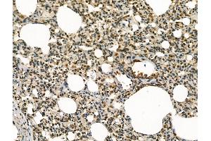 anti-Bloom Syndrome RecQ Like Helicase (BLM) (Internal Region) antibody