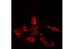 ABIN6274982 staining Hela cells by IF/ICC. (CDC42EP5 Antikörper  (N-Term))
