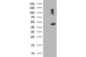 Western Blotting (WB) image for anti-Tubulin, alpha 8 (TUBA8) antibody (ABIN1501562) (TUBA8 Antikörper)