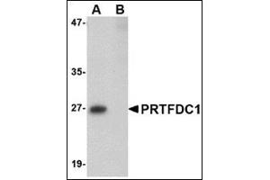 Western blot analysis of PRTFDC1 in human brain tissue lysate with this product at 1 μg/ml in the (A) absence and (B) presence of blocking peptide. (PRTFDC1 Antikörper  (Center))