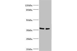 Western blot All lanes: HNRNPD antibody at 4 μg/mL Lane 1: Hela whole cell lysate Lane 2: 293T whole cell lysate Secondary Goat polyclonal to rabbit IgG at 1/10000 dilution Predicted band size: 39, 37, 33, 31 kDa Observed band size: 39 kDa (HNRNPD/AUF1 Antikörper  (AA 1-306))