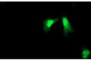 Image no. 2 for anti-ADP-Ribosylation Factor-Like 11 (ARL11) antibody (ABIN1496714) (ARL11 Antikörper)