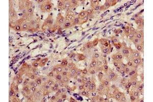 Immunohistochemistry of paraffin-embedded human liver tissue using ABIN7144667 at dilution of 1:100 (AADAC Antikörper  (AA 24-399))