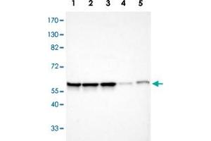 Western blot analysis of Lane 1: Human cell line RT-4; Lane 2: Human cell line U-251MG sp; Lane 3: Human cell line A-431; Lane 4: Human liver tissue; Lane 6: Human tonsil tissue with APEX1 polyclonal antibody  at 1:100-1:250 dilution. (APEX1 Antikörper)