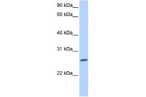 ZNF664 antibody used at 0. (ZNF664 Antikörper  (N-Term))