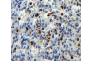 Used in DAB staining on fromalin fixed paraffin- embedded spleen tissue (ATG16L1 Antikörper  (AA 1-284))