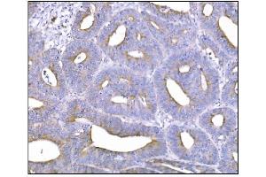 IHC analysis of NDEL1 using anti-NDEL1 antibody (ABIN7602511). (NDEL1 Antikörper  (AA 80-320))